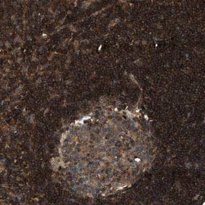 Immunohistochemistry-Paraffin: SAMD9 Antibody [NBP1-91244]