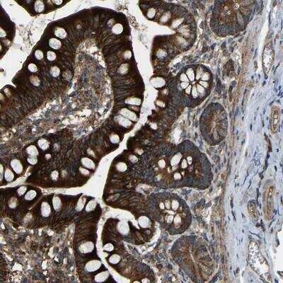Immunohistochemistry: SAMD9L Antibody [NBP1-91243]