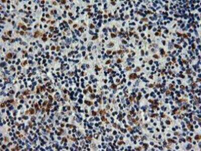 Immunohistochemistry-Paraffin: SAMHD1 Antibody (OTI3F5) [NBP2-03285]