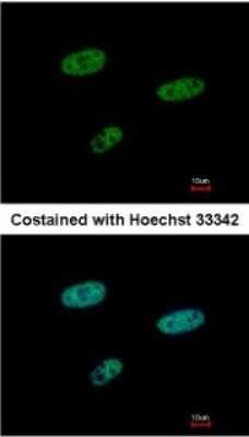 Immunocytochemistry/ Immunofluorescence: SAMHD1 Antibody [NBP1-31432]