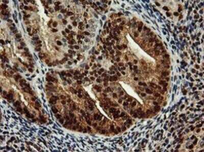 Immunohistochemistry: SAMHD1 Antibody (OTI3F5) - Azide and BSA Free [NBP2-73979]