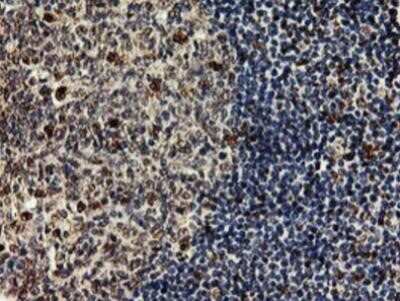 Immunohistochemistry: SAMHD1 Antibody (OTI3F5) - Azide and BSA Free [NBP2-73979]