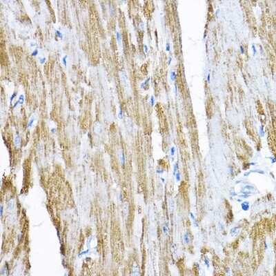 Immunohistochemistry-Paraffin: SAMM50 Antibody - BSA Free [NBP2-94852]