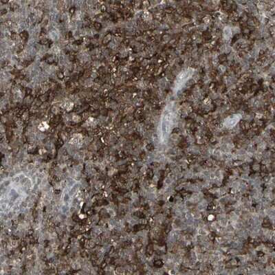 Immunohistochemistry-Paraffin: SAMSN1 Antibody [NBP1-82599]