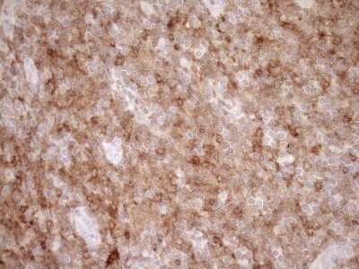 Immunohistochemistry: SAMSN1 Antibody (OTI7F5) - Azide and BSA Free [NBP2-73984]