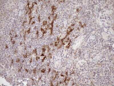 Immunohistochemistry: SAMSN1 Antibody (OTI7F5) - Azide and BSA Free [NBP2-73984]