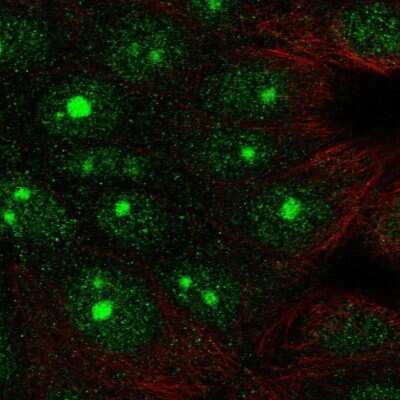 Immunocytochemistry/ Immunofluorescence: SAP102 Antibody [NBP2-58864]