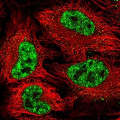 Immunocytochemistry/ Immunofluorescence: SAP155 Antibody [NBP2-47291]