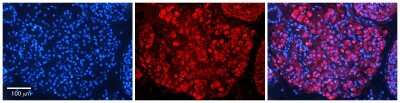 Immunohistochemistry-Paraffin: SAP18 Antibody [NBP2-88212]