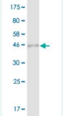 Western Blot: SAP30 Antibody (1D3) [H00008819-M03]