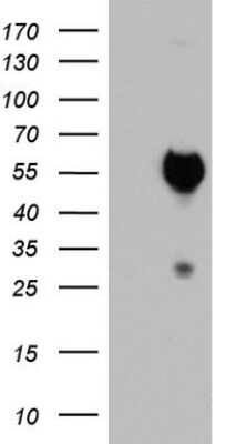 Western Blot: SAP30BP Antibody (OTI4H1) [NBP2-45686]
