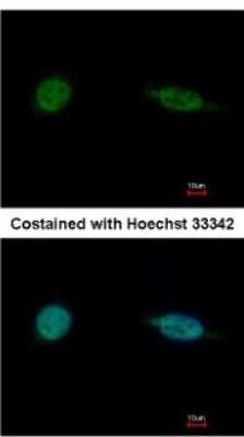 Immunocytochemistry/ Immunofluorescence: SAP30BP Antibody [NBP1-31695]