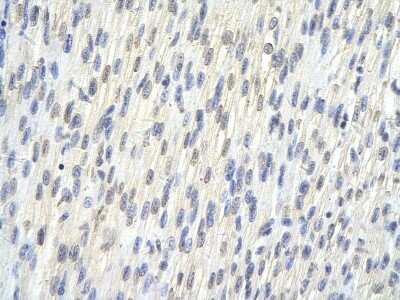 Immunohistochemistry-Paraffin: SAP30BP Antibody [NBP3-10320]