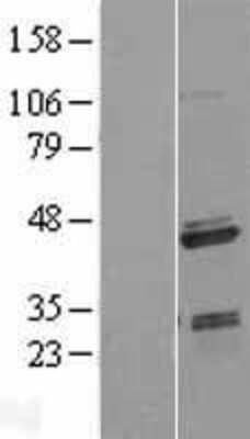 Western Blot: SAP30BP Overexpression Lysate [NBL1-15686]