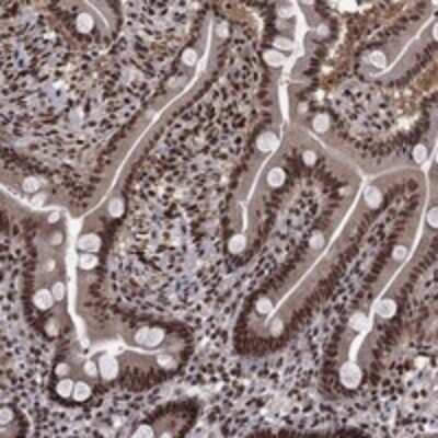 Immunohistochemistry-Paraffin: SAP30L Antibody [NBP3-17535]