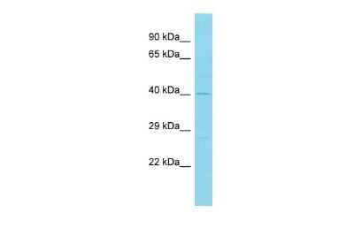 Western Blot: SAPCD2 Antibody [NBP2-83493]