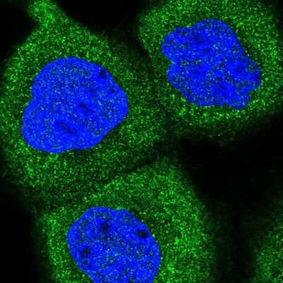 Immunocytochemistry/ Immunofluorescence: SAPS1 Antibody [NBP2-48803]