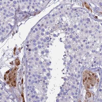 Immunohistochemistry-Paraffin: SAPS1 Antibody [NBP2-48803]