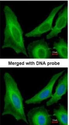 Immunocytochemistry/ Immunofluorescence: SAR1B Antibody [NBP1-32725]