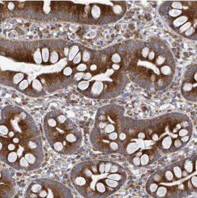 Immunohistochemistry: SAR1B Antibody [NBP2-33521]
