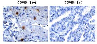 Immunohistochemistry-Paraffin: SARS-CoV-2 NSP10 Antibody - BSA Free [NBP3-07057]