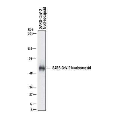 Western Blot: SARS-CoV-2 Nucleocapsid AntibodyBSA Free [NBP3-00510]