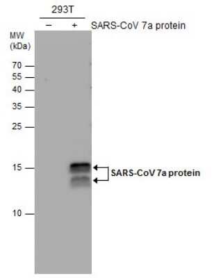 Western Blot: SARS-CoV-2 ORF7a Antibody (3C9) [NBP3-13521]
