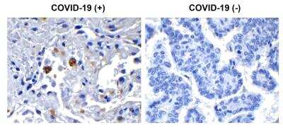 Immunohistochemistry: SARS-CoV-2 nsp13 Antibody - BSA Free [NBP3-07056]