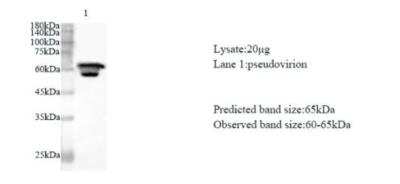 Western Blot: SARS-CoV-2 nsp13 AntibodyAzide and BSA Free [NBP3-07964]