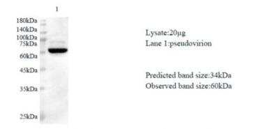 Western Blot: SARS-CoV-2 nsp16 AntibodyAzide and BSA Free [NBP3-07965]