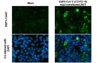 Immunocytochemistry/ Immunofluorescence: SARS-CoV-2 nsp3 Antibody [NBP3-13467]