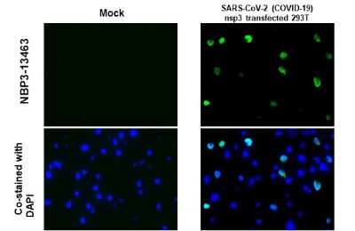 Immunohistochemistry-Paraffin: SARS-CoV-2 nsp3 Antibody [NBP3-13463]