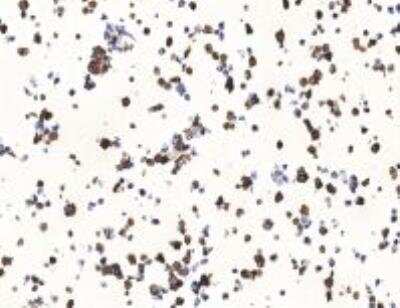 Immunocytochemistry/ Immunofluorescence: SARS Nucleocapsid Protein Antibody (001) [NBP2-90988]