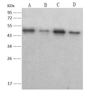 Western Blot: SARS Nucleocapsid Protein Antibody (05) [NBP3-06413]