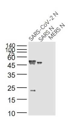 Western Blot: SARS Nucleocapsid Protein Antibody (14B3D)Azide and BSA Free [NBP3-07063]