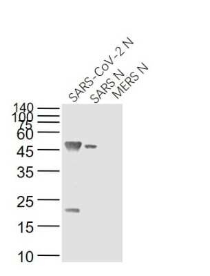 Western Blot: SARS Nucleocapsid Protein Antibody (8G8A)Azide and BSA Free [NBP3-07064]