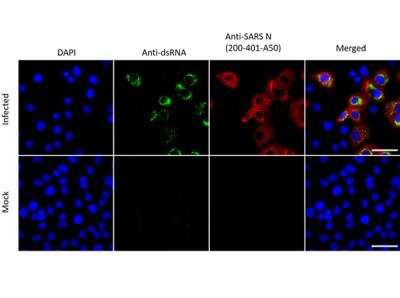 Immunocytochemistry/ Immunofluorescence: SARS Nucleocapsid Protein Antibody [NBP2-44205]