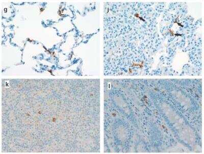 Immunohistochemistry: SARS Nucleocapsid Protein Antibody - BSA Free [NB100-56576]