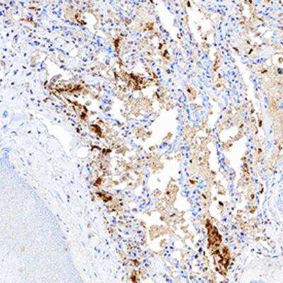 Immunohistochemistry: SARS Nucleocapsid Protein Antibody Pack [NBP3-05695]