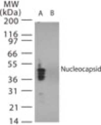 Western Blot: SARS Nucleocapsid Protein Antibody [NB100-56049]