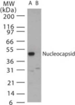 Western Blot: SARS Nucleocapsid Protein AntibodyBSA Free [NB100-56050]