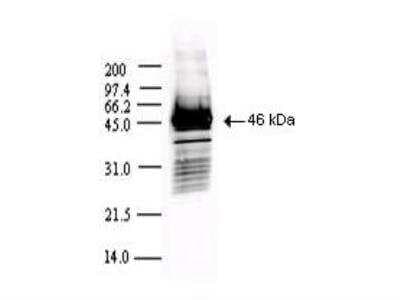 Western Blot: SARS Nucleocapsid Protein Antibody [NBP2-44205]