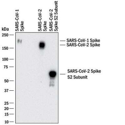 Western Blot Detection of SARS-CoV-1 and SARS CoV-2 Spike Protein Using SARS Spike Protein Antibody