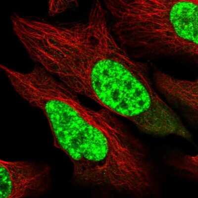 Immunocytochemistry/ Immunofluorescence: SART1 Antibody [NBP1-89024]