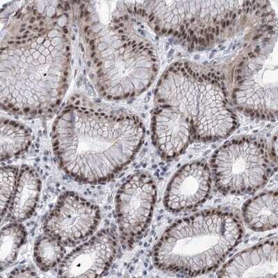 Immunohistochemistry-Paraffin: SART1 Antibody [NBP1-89023]