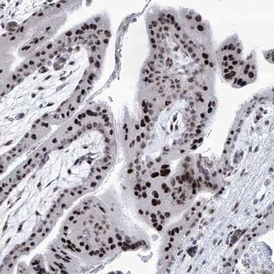 Immunohistochemistry-Paraffin: SART1 Antibody [NBP1-89024]
