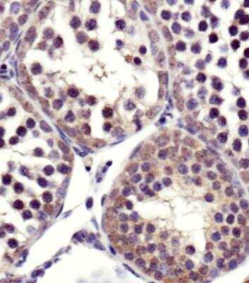 Immunohistochemistry-Paraffin: SART1 Antibody - BSA Free [NBP2-14836]
