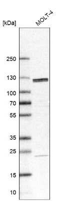 Western Blot: SART1 Antibody [NBP1-89024]