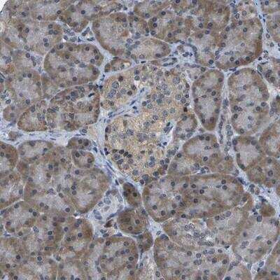 Immunohistochemistry-Paraffin: SART2 Antibody [NBP1-87962]