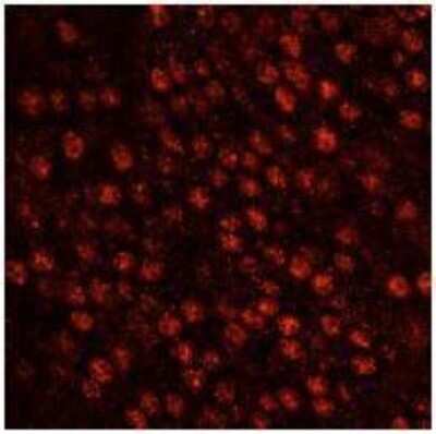 Immunocytochemistry/ Immunofluorescence: SART3 Antibody [NB100-74648]